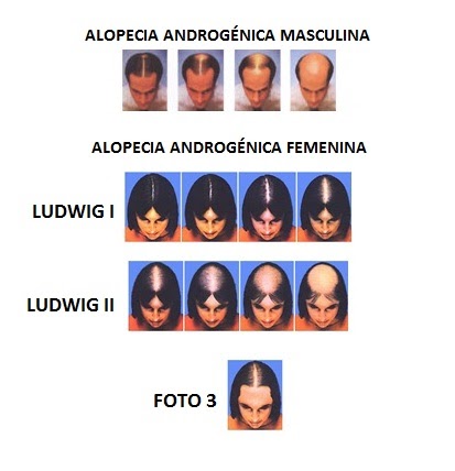 La máscara contra la caída de los cabello yaichnaya